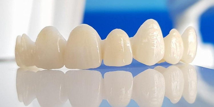 Zirconia Dental Crowns: Benefits, Types and Cost